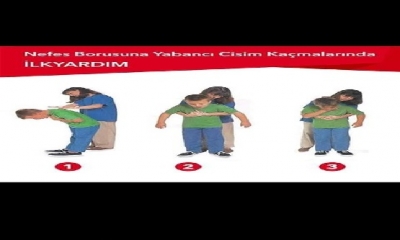 Nefes borusuna cisim kaçması halinde İlk Yardım