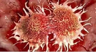 Önemli! Mutlaka Okumalısınız. Kanser hiç yoktan artmadı !