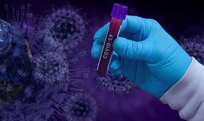  Oxford'dan korkutan 'aşı' açıklaması: Aşı nedeniyle 1 kişi öldü