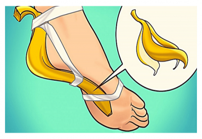 Sadece Muz Kabuğuyla 8 Hastalığa Çözüm Bulabilirsiniz