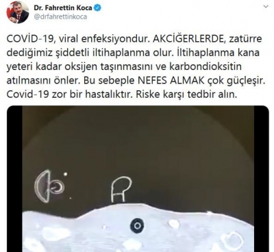 Sağlık Bakanı Fahrettin Koca Adım Adım Corona Aşamasını Paylaştı