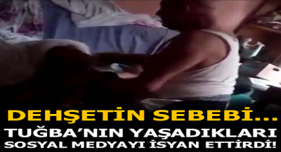 Sosyal Medyayı Ayağa Kaldıran İşkenceci Baba Tutuklandı;Genç Kızın Anlattıkları Kan Dondurdu