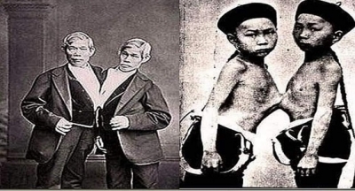 Tarihin En Ünlü Siyam İkizleri Chang ve Eng Bunker Kardeşlerin Tuhaf Hikayesi