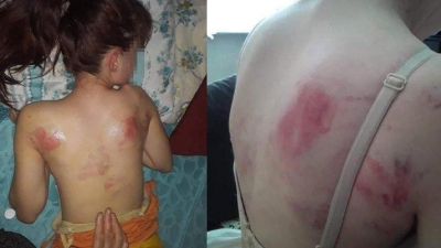 Telefon şifresini söylemedi diye kızını bu hale getirdi