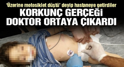 Üzerine Motor Düştü Denilip Hastaneye Kaldırılan 3 Yaşındaki Çocukla İlgili Gerçek, Kan Dondurdu