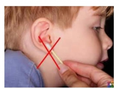 Uzmanlar, kulak kirinin, kulak için oldukça faydalı bir salgı olduğunu ve çubuklarla kesinlikle temizlenmemesi gerektiğini söylüyor.