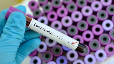 Yapılan Araştırmaya Göre Vücuttaki Eksikliği Corona Riskinde Ölüm Oranını Arttırıyor