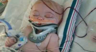 Yataktan Düşen Bebek Bu Hale Geldi, Anne Şimdi Tüm Ebeveynleri Uyarıyor