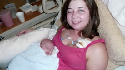 Yeni Doğum Yapan Anne Sağ Gözünü Açamıyordu – Doktorlar Gerçeği Anlatınca Herkes Şoke Oldu