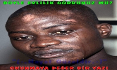 Yüzü simsiyahtı.  Ama kendisi boyamamıştı ki! Kaldı ki, kalbi bembeyazdı. Buna rağmen onu basite alanlar vardı.  Dedi ki: