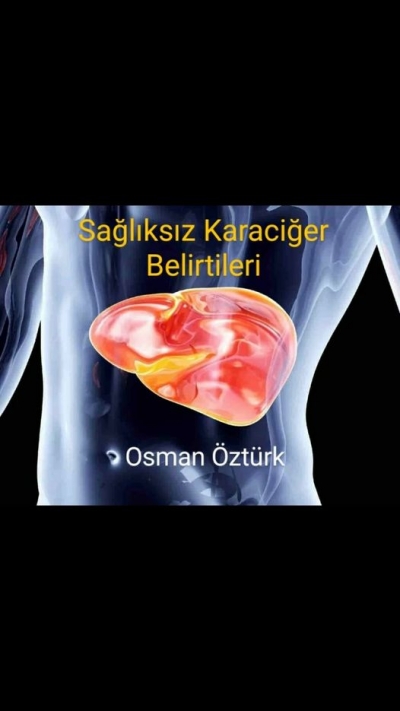 Zayıf karaciğere sahip olduğumuzu tespit etmenin kolay yolları.