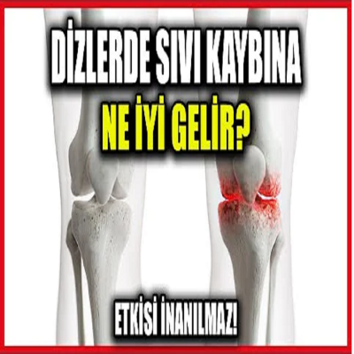 1 Ayda Dizlerdeki Sıvı Kaybından Kolayca Kurtulun!