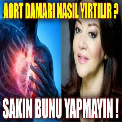 Aort Damarı Nasıl Yırtılır ? Sakın Bunu Yapmayın !