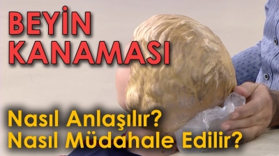 Beyin Kanaması Nasıl Anlaşılır ve Nasıl Müdahale Edilir?