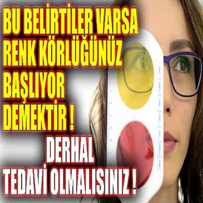 Bu Belirtiler Varsa Renk Körlüğünüz Başlıyor Demektir. Derhal Tedavi Olmalısınız !