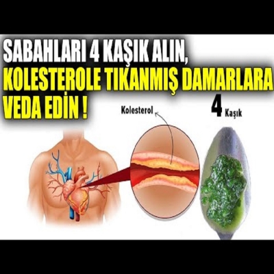 Sabahları 4 Kaşık Alın Kolesterole Tıkanmış Damarlara Veda Edin !