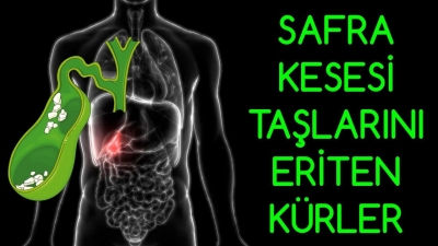 Safra Taşını Düşüren 5 Besin Mutlaka Tüketin !