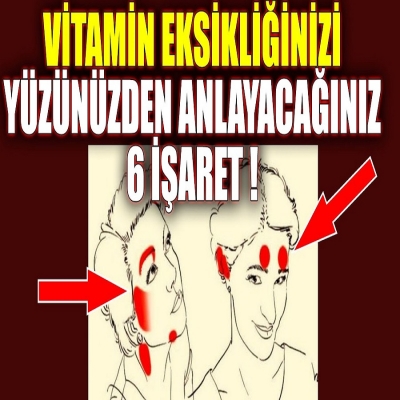 Vitamin eksikliğinizi yüzünüzden anlayabileceğiniz 6 işaret ! TEDAVİSİ İÇİN BESİNLER !